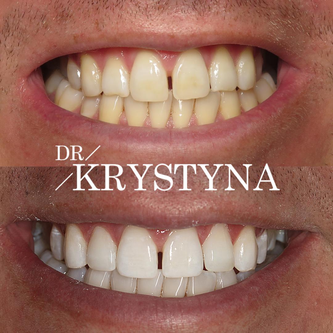 Dr Krystyna Before & After