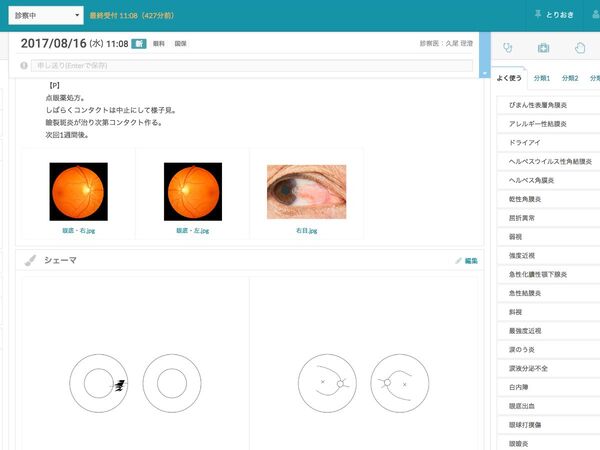 眼科診療所向けのクラウド型電子カルテ「CLIPLA Eye」提供開始