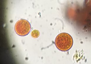 Microscopy image showing three cells in focus. They are round in shape and filled with smaller vesicles. Two are large and red in color. The smaller cell in the middle is greenish with red tints throughout.