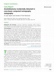 Research paper thumbnail of Ameloblastoma incidentally detected in cone-beam computed tomography sialography