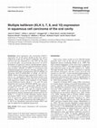 Research paper thumbnail of Multiple kallikrein (KLK 5, 7, 8, and 10) expression in squamous cell carcinoma of the oral cavity