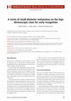 Research paper thumbnail of A series of small-diameter melanomas on the legs: dermoscopic clues for early recognition