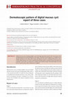 Research paper thumbnail of Dermatoscopic pattern of digital mucous cyst: report of three cases