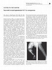 Research paper thumbnail of Successful second haploidentical SCT in osteopetrosis