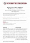 Research paper thumbnail of Dermoscopic Features of External Ear Melanoma: A Case Series