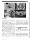 Research paper thumbnail of EP246 Reconsidering the role of ErbB receptors status among young patients with CIN 3 and cervical cancer