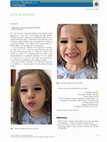 Research paper thumbnail of Influenza a ( H1N1 )‐Associated Paediatric Facial Paralysis