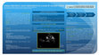 Research paper thumbnail of Fungal Prosthetic Valve Endocarditis as a Cause of Ischemic Stroke