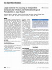 Research paper thumbnail of Large Bacterial Floc Causing an Independent Extraradicular Infection and Posttreatment Apical Periodontitis: A Case Report