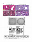 Research paper thumbnail of Supplementary Figure 3 from Adaptive Basal Phosphorylation of eIF2α Is Responsible for Resistance to Cellular Stress–Induced Cell Death in &lt;i&gt;Pten&lt;/i&gt;-Null Hepatocytes