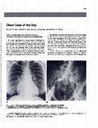 Research paper thumbnail of Chest case of the day