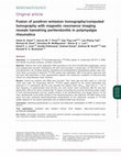 Research paper thumbnail of Fusion of positron emission tomography/computed tomography with magnetic resonance imaging reveals hamstring peritendonitis in polymyalgia rheumatica