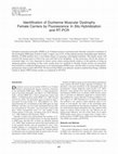 Research paper thumbnail of Identification of Duchenne Muscular Dystrophy Female Carriers by Fluorescence In Situ Hybridization and RT-PCR