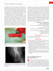 Research paper thumbnail of Low-Cost Simulation Plank for Microsurgical Success