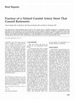 Research paper thumbnail of Fracture of a Nitinol Carotid Artery Stent That Caused Restenosis