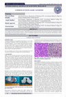 Research paper thumbnail of Lymphoma of Testis-A Rare Case Report