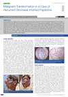 Research paper thumbnail of Malignant Transformation in a Case of Recurrent Sinonasal Inverted Papilloma