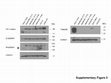 Research paper thumbnail of Supplementary Figure 3 from Establishment and Characterization of Novel Cell Lines from Sinonasal Undifferentiated Carcinoma