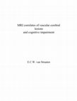 Research paper thumbnail of Measuring progression of cerebral white matter lesions on MRI: Visual rating and volumetrics