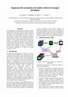 Research paper thumbnail of Segmentación automática de tejido cerebral en imagen preclínica