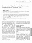 Research paper thumbnail of Gene expression profiling of liver metastases from colorectal cancer as potential basis for treatment choice