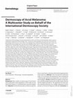 Research paper thumbnail of Dermoscopy of Acral Melanoma: A Multicenter Study on Behalf of the International Dermoscopy Society