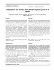 Research paper thumbnail of Imaging Diagnosis of Acute Septic Arthritis of Hip