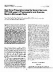 Research paper thumbnail of Root canal preparation using the second harmonic KTP:YAG laser: a thermographic and scanning electron microscopic study