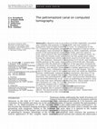 Research paper thumbnail of The petromastoid canal on computed tomography