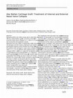 Research paper thumbnail of Alar Batten Cartilage Graft: Treatment of Internal and External Nasal Valve Collapse