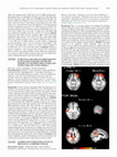 Research paper thumbnail of Evidence of Amyloid on Florbetaben-Pet is Associated With Reduced Episodic Memory 10 Years Prior: Results From the Women’s Healthy Ageing Project