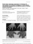 Research paper thumbnail of Partial distal aphalangia, duplication of metatarsal IV, microcephaly, and borderline intelligence