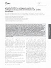 Research paper thumbnail of p38delta/MAPK13 as a diagnostic marker for cholangiocarcinoma and its involvement in cell motility and invasion