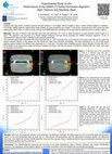 Research paper thumbnail of SU-E-I-39: Experimental Study On the Performance of the OMAR CT Artifact Correction Algorithm Near Titanium and Stainless Steel