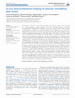 Research paper thumbnail of In vivo bioluminescence imaging of vascular remodeling after stroke