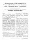 Research paper thumbnail of Custom-designed plaque radiotherapy for nonresectable iris melanoma in 38 patients: tumor control and ocular complications