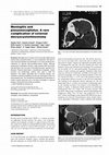 Research paper thumbnail of Meningitis and pneuomocephalus. A rare complication of external dacryocystorhinostomy