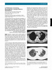 Research paper thumbnail of A pulmonary cavernous hemangioma causing massive hemoptysis