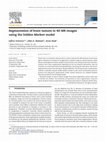 Research paper thumbnail of Segmentation of brain tumors in 4D MR images using the hidden Markov model