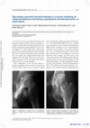 Research paper thumbnail of Secondary synovial chondromatosis