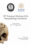 Research paper thumbnail of Parietal thinning, comparative radiological study of 6 cases, one from ancient Egypt and five from Spain (XVI Century)