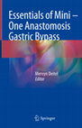 Research paper thumbnail of Essentials of Mini ‒ One Anastomosis Gastric Bypass