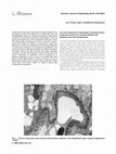 Research paper thumbnail of Timing of allogeneic BMT for CML patients in India: Does it affect response?