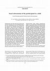 Research paper thumbnail of Facial schwannoma of the parotid gland in a child