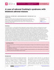 Research paper thumbnail of A case of adrenal Cushing’s syndrome with bilateral adrenal masses