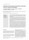 Research paper thumbnail of Evaluation of the anterior and posterior ethmoidal canal by computed tomography