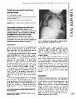 Research paper thumbnail of Total parenteral nutrition tamponade