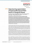 Research paper thumbnail of Deep learning segmentation of hyperautofluorescent fleck lesions in Stargardt disease