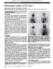 Research paper thumbnail of Radioiodine Uptake in the Chest