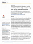 Research paper thumbnail of Anti-cancer agents in Saudi Arabian herbals revealed by automated high-content imaging